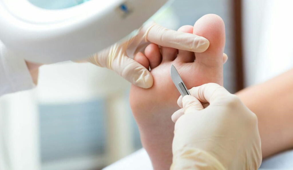 Лікар-подолог: експерт зі здоров’я стоп лікар подолог