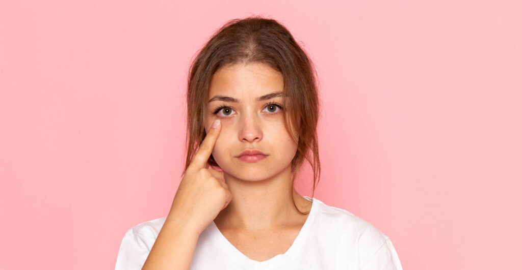 Як прибрати мішки під очима