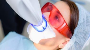 Профессиональное отбеливание зубов в Одессе